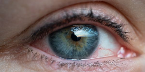 Can Farts Cause Pink Eye?